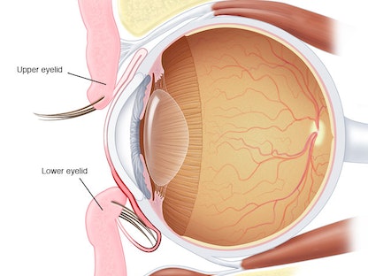 صورة توضح القرنية وحالة الشتر الداخلي للعين. - Mayo Clinic