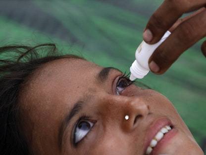 فتاة باكستانية خلال تلقي جرعة من قطرة للعين لعلاج عدوى أثناء لجوئها مع أسرتها في مخيم إغاثة لضحايا الفيضانات في سوكور بإقليم السند الباكستاني- 15 سبتمبر 2010 - REUTERS
