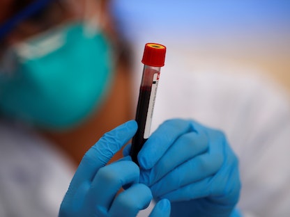 عامل صحي يحمل عينة دم أثناء اختبار في منطقة ميرافلوريس في عاصمة بيرو ليما - REUTERS