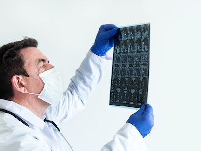 طبيب يُعاين صورة أشعة - Getty Images