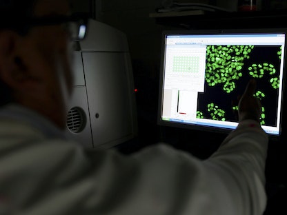 صورة خلايا على شاشة في معهد أبحاث السرطان في ساتون ببريطانيا- 15 يوليو 2013 - REUTERS