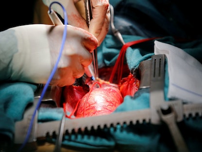 طبيب يجري عملية قلب في عيادة بمدينة بوردو الفرنسية. 25 أكتوبر 2018 - REUTERS