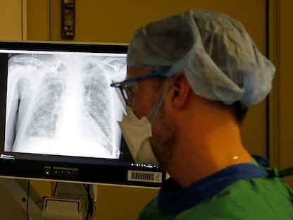أشعة صدر لأحد المرضى في ألمانيا. 21 ديسمبر 2020 - REUTERS