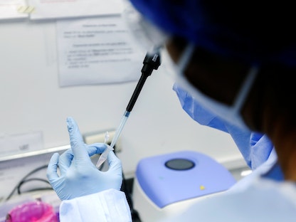 اختبار عيّنة من مصاب بفيروس كورونا خلال فحص مخبري - REUTERS