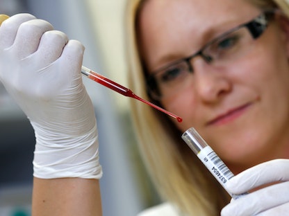 تفحص عينات من الدم في أحد مختبرات ألمانيا. 5 سبتمبر 2016 - REUTERS