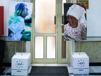 مصر | جدل واسع بشأن التبرع بالجلد.. ومقترح برلماني لإنشاء "بنك للأنسجة"