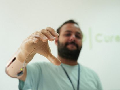 شركة ناشئة تونسية تصنع أطرافاً اصطناعية تعمل بالـذكاء الاصطناعي