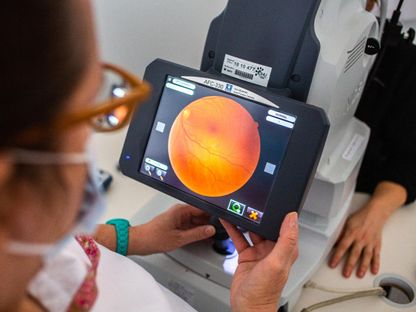 طبيبة تفحص عين مريضة باستخدام تصوير الشبكية بإحدى العيادات في بلدة ليموج جنوب غرب فرنسا. 4 فبراير 2021 - AFP