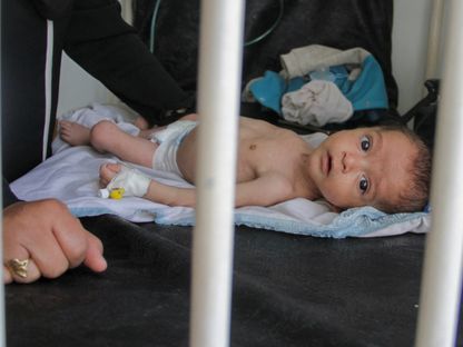 الطفل الفلسطيني مجد سالم يعاني من سوء التغذية واكتسب 300 جرام فقط في 6 أشهر ويرقد على سرير بمستشفى كمال عدوان في شمال قطاع غزة بفلسطين. 9 مايو 2024 - REUTERS
