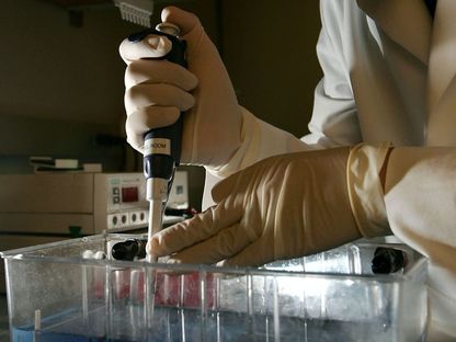 عامل بمختبر للأمراض يفحص عينات مأخوذة من شخص يحتمل إصابته بمرض سرطان الرئة - Getty Images