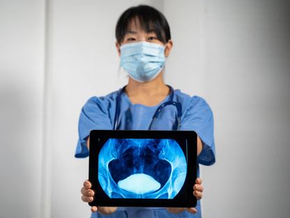 طبيبة تحمل شاشة تظهر عليها صورة للمثانة بالأشعة السينية. 9 فبراير 2021 - AFP