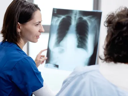 سرطان الرئة لدى غير المدخنين.. مرض شائع "مهمل بحثياً"