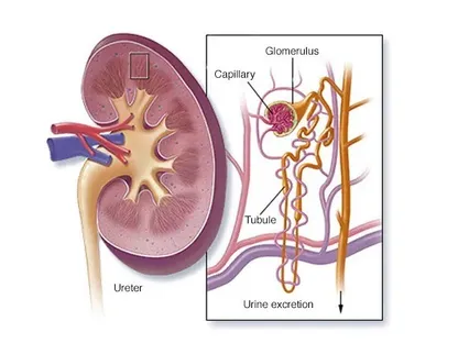 صورة مقطعية للكلية - Mayo Foundation For Medical Education And Research