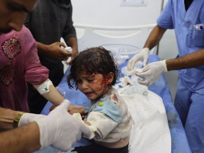 طفلة فلسطينية أصيبت في غارة إسرائيلية على خيام لاجئين في رفح بجنوب قطاع غزة. 26 مايو 2024 - AFP