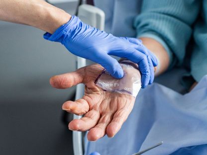 امرأة تستخدم علاجاً موضعياً على الجلد في فرنسا. 4 فبراير 2021 - AFP