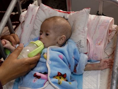 رضيعة فلسطينية تعاني من سوء التغذية في مستشفى ناصر جنوب قطاع غزة. 30 أبريل2025 - Reuters