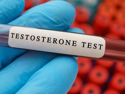 عينة من الدم لإجراء فحص في مختبر لقياس مستوى هرمون التستوستيرون - AFP