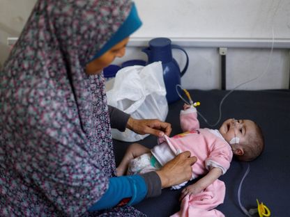 طفل فلسطيني يعاني من سوء التغذية يتلقى العلاج في مركز "العودة" الصحي في رفح بجنوب قطاع غزة. 1 أبريل 2024 - REUTERS