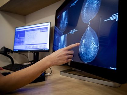 إجراء فحص سرطان الثدي بمركز أبحاث في هولندا. 29 نوفمبر 2023 - AFP