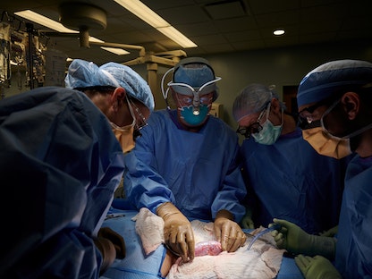 جراحون في جامعة نيويورك لانجون الأميركية يزرعون كلية خنزير في جسم إنسان - 20 أكتوبر 2021 - via REUTERS