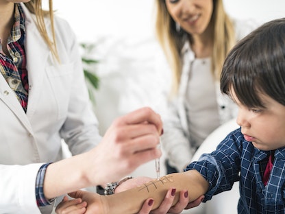 طفل يخضع لاختبارات حساسية الجلد. 17 سبتمبر 2019  - AFP