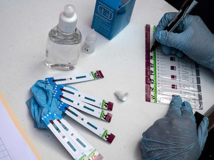 عاملة صحية تتحقق من عملية الاختبارات السريعة لفيروس نقص المناعة البشرية "الإيدز" في ميدان موريلوس في كاراكاس. 3 ديسمبر 2021  - AFP