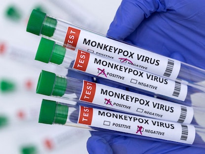 أنبابيب اختبار للكشف عن عينات مصابة وغير مصابة بفيروس "جدري القرود" - REUTERS