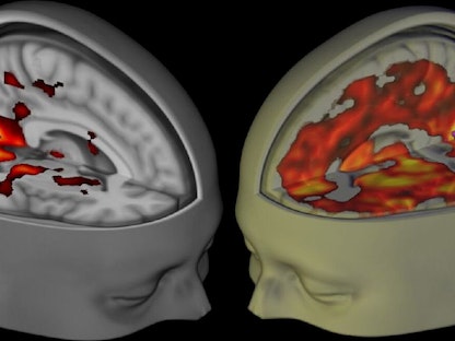 صورة ثلاثية الأبعاد للدماغ - REUTERS
