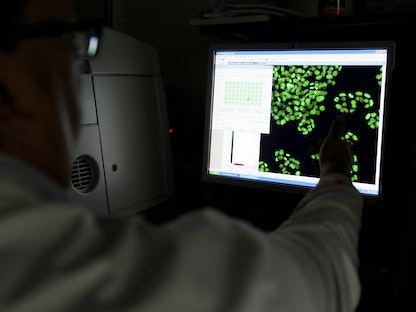عالم يشير إلى صورة خلايا على شاشة في معهد أبحاث السرطان في ساتون ببريطانيا- 15 يوليو 2013 - REUTERS