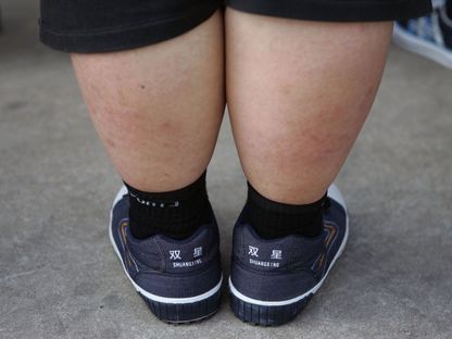 طفل يعاني السمنة خلال مشاركته في تجمع صيفي لخسارة الوزن - Getty Images