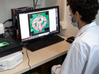 طبيب يطالع صورة ثلاثية الأبعاد للدماغ. 17 أغسطس 2021 - REUTERS