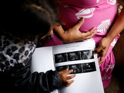 برازيلية حامل في شهرها السادس تعرض صور موجات فوق صوتية لابنتها في ساو باولو جنوب شرقي البرازيل. 15 سبتمبر 2022 - REUTERS