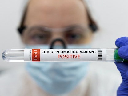 أنبوبة اختبار لأحد المصابين بمتحور فيروس كورونا "أوميكرون" في الولايات المتحدة. 15 يناير 2022 - REUTERS