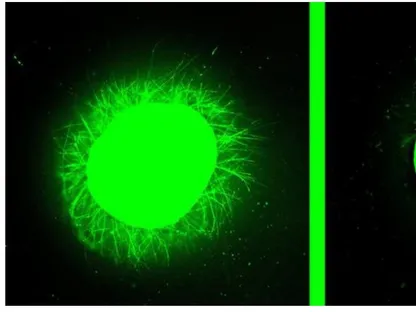 "الجزيئات الراقصة".. علاج تجريبي جديد لإصابات الحبل الشوكي