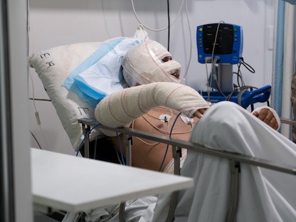 رجل أصيب خلال انفجار خزان وقود في عكار يتلقى العلاج في مستشفى في بيروت، لبنان، 15 أغسطس 2021 - REUTERS