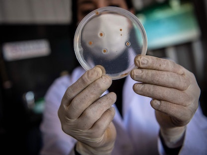 عالمة تكنولوجيا حيوية تمسك بعينات من البكتيريا بمختبر في تشيلي - 21 سبتمبر 2021 - AFP