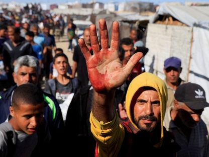 فلسطيني على يده بقع دماء بعد أن حمل مصابين كانوا يسعون للحصول على مساعدات من (مؤسسة غزة الإنسانية) المدعومة من الولايات المتحدة في خان يونس بجنوب قطاع غزة. 29 مايو 2025 - REUTERS