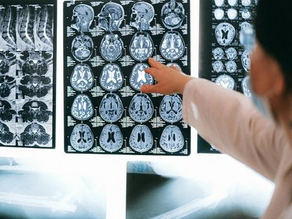 الهند.. 19 حالة وفاة بسبب "الأميبا آكلة الدماغ" والسلطات تعلن التأهب