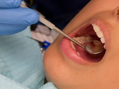دراسة: شرب الماء قد يقلل من احتمالية حدوث تسوس الأسنان