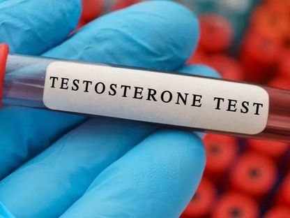 عينة من الدم لإجراء فحص في مختبر لقياس مستوى هرمون التستوستيرون - AFP