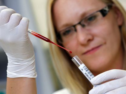 فحص عينات من الدم في أحد مختبرات ألمانيا. 5 سبتمبر 2016 - REUTERS