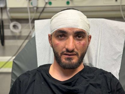 صورة تظهر الإصابات التي تعرض لها مصور وكالة "الأناضول" مصطفى الخاروف من قبل القوات الإسرائيلية. 15 ديسمبر 2023 - وكالة "الاناضول"