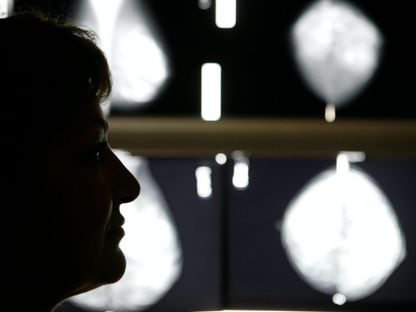 مريضة بسرطان الثدي تستمع إلى طبيبها بعد الفحص الطبي الإشعاعي في أحد مستشفيات أثينا، اليونان. 29 أكتوبر 2008. - REUTERS