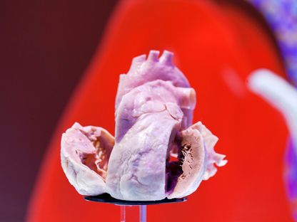 مجسم قلب بشري مغطى بالبلاستيك في مكان اجتماع الجمعية الأوروبية لأمراض القلب في أمستردام، هولندا. 2 سبتمبر 2013. - REUTERS