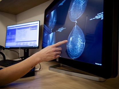 أخصائية تصوير بالأشعة مع امرأة خلال إجرائها فحصاً لسرطان الثدي في مركز أبحاث السكان في هولندا. 29 نوفمبر 2023 - AFP