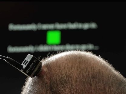 صورة غير مؤرخة لجهاز عصبي يمكن زرعه في الدماغ يتيح ترجمة الإشارات العصبية إلى أصوات - www.ucdavis.edu