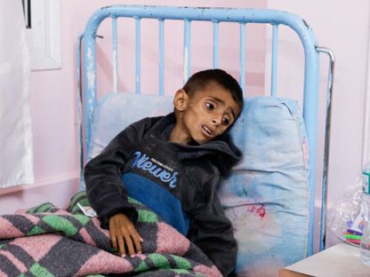 طفل فلسطيني تبدو عليه علامات سوء التغذية يرقد على سرير في مستشفى ناصر حيث يتلقى العلاج في خان يونس جنوبي قطاع غزة. 1 مايو 2025 - reuters