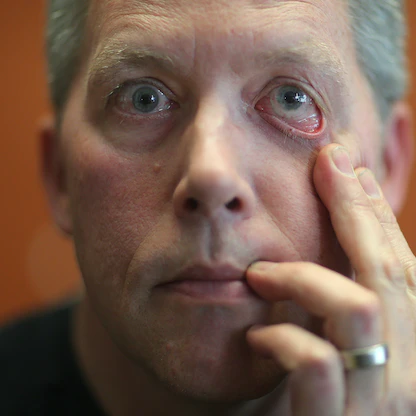 كفيف يستعيد بصره جزئياً في تجربة لعلاج جيني جديد