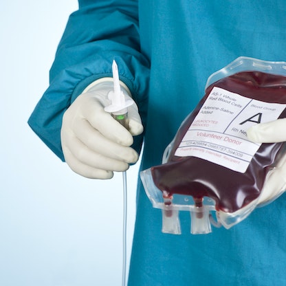 كل ما يجب معرفته قبل إجراء عملية نقل الدم