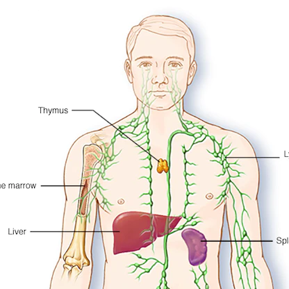 سرطان الدم "اللوكيميا".. أعراضه وأنواعه وطرق العلاج